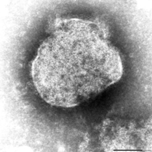 はしか　沖縄県が注意喚起　神奈川県20代男性が感染　羽田空港から石垣市に滞在歴