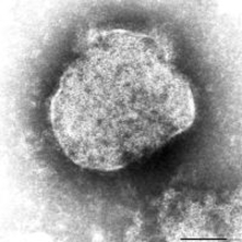 はしか　沖縄県が注意喚起　神奈川県20代男性が感染　羽田空港から石垣市に滞在歴