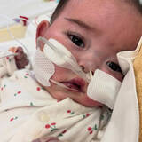 「「生きていてくれて良かった」妊娠20週で告げられた疾患と術後の“低酸素脳症”　324日間の入院を経た赤ちゃんの1年」の画像1