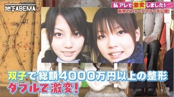 双子で整形、総額4000万円　顔へのコンプレックスは中学時代“周囲から比較”「姉の方が可愛い」