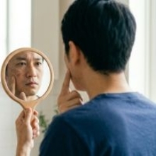 男女のシミに違いあり？ 「できると濃く根が深くなる」“男性のシミ対策”最前線