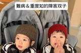 「ドラベ症候群と重度の知的障害を抱える双子ママの願い「障害のある子も受け入れてもらえる社会にしたい」」の画像1