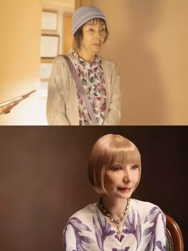 研ナオコ、“美容整形”ビフォーアフター公開　『ダウンタイム』劇的変貌にSNS驚愕