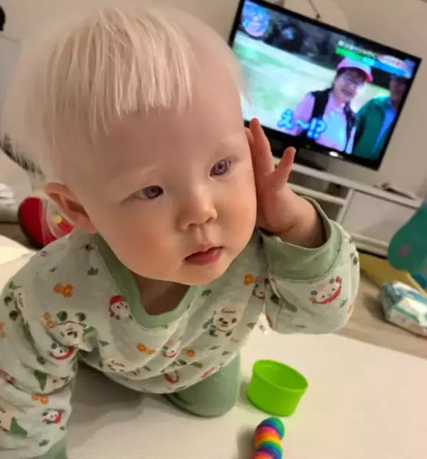 “天使すぎる”アルビノ赤ちゃんの散髪動画が111万回再生、心無い言葉乗り越える親の愛「あなたの存在は周りを明るくしている」