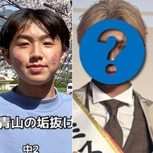 とにかく肌が荒れていて…ニキビ肌だった少年の5年後、美肌になりミスター青山に「何かを成し遂げたいなら行動しないと何も始まらない」