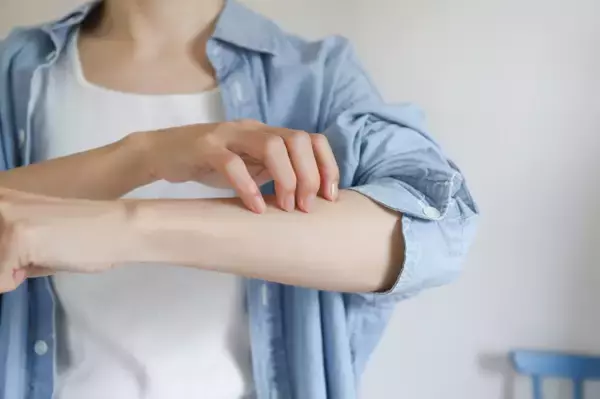 「酷暑日」元年…猛暑・酷暑に悪化・発症しやすい疾患は？「湿疹」「じんましん」「帯状疱疹」を医師が解説