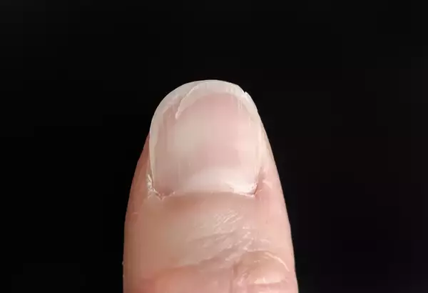 「爪の亀裂は放置しない」気分が落ちるだけじゃない…“爪の補修材”で爪トラブルも防ぐ