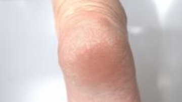 触った瞬間ゾッとする…「岩化かかと」になる前にやるべき冬の角質・保湿対策