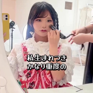 重度のアトピー性皮膚炎と向き合う女性、SNSで“愛用コスメ”を発信しない真意に反響「安易に教えないことが、私にできる最大の誠実さ」