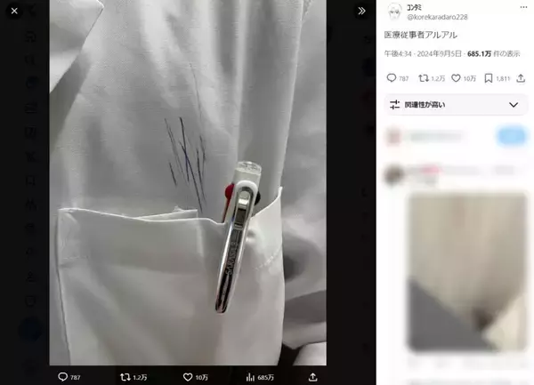「医療従事者あるある？胸ポケット上のボールペン跡に他業種からも共感の声続々」の画像