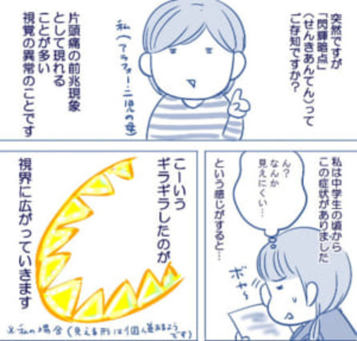 つらい片頭痛の前兆 閃輝暗点 意外と知られていないこの状態と頭痛の話 18年4月16日 エキサイトニュース