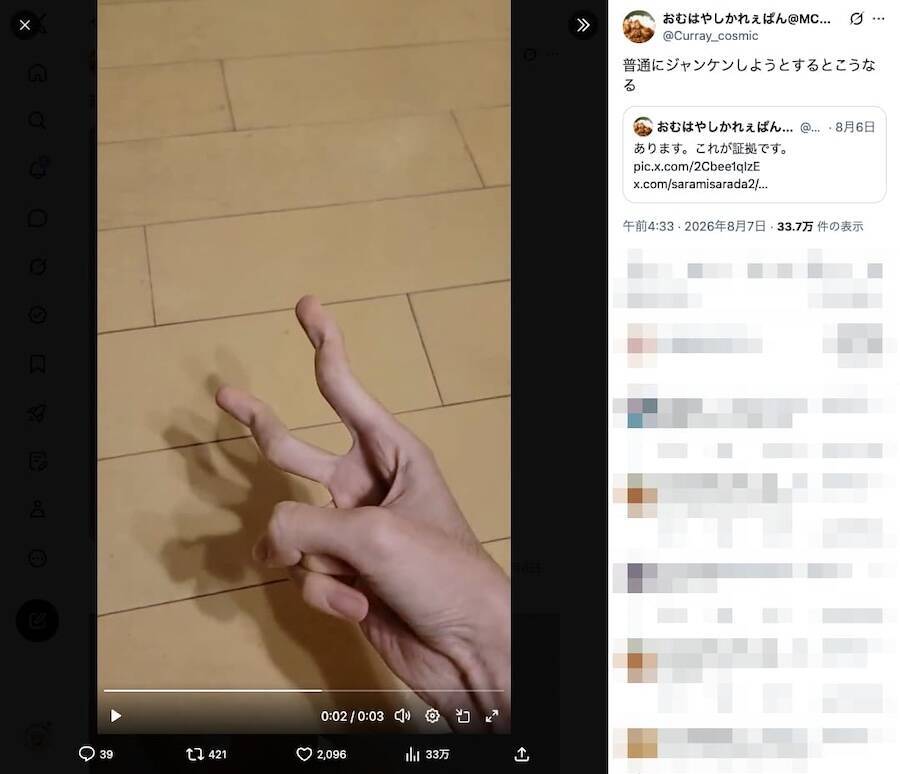 まるで指の知恵の輪　信じられない可動域を持つXユーザーが話題「関節何個あんの」