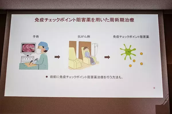 「がん治療“第4の柱”「免疫チェックポイント阻害薬」製薬会社がセミナー開催」の画像