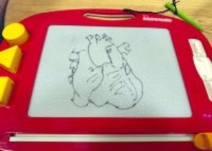 子どもに「ハート描いて」と頼まれた心臓外科医　ガチすぎる“ハート”を描き上げる