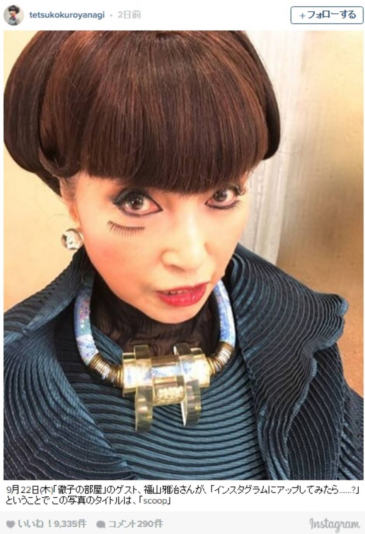 黒柳徹子さん インスタグラム始めました きっかけは福山雅治さんの アップしてみたら のひとこと 16年9月26日 エキサイトニュース