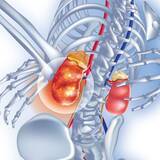 「｢肺が真っ白でステージ4｣義母実母の介護をやり切り直面した試練の中､60代嫁が思わずキレた夫の無神経発言」の画像2