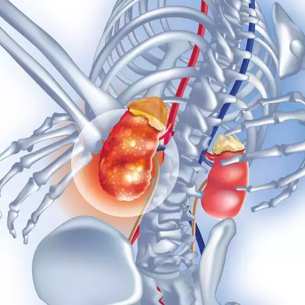 「｢肺が真っ白でステージ4｣義母実母の介護をやり切り直面した試練の中､60代嫁が思わずキレた夫の無神経発言」の画像