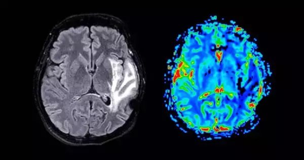 「｢肺が真っ白でステージ4｣義母実母の介護をやり切り直面した試練の中､60代嫁が思わずキレた夫の無神経発言」の画像