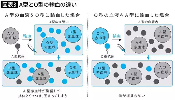 「｢O型→A型｣はいいけど､｢A型→O型｣はダメ…誰にでも輸血できる｢万能血液｣の最後の落とし穴」の画像