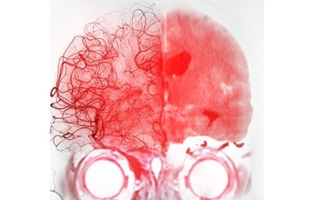 インフル･コロナより"深刻な病気"…最悪､年末年始に命を落とす人が暮らす家の特徴と正月に口にする食べ物