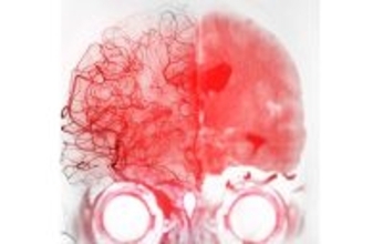 インフル･コロナより"深刻な病気"…最悪､年末年始に命を落とす人が暮らす家の特徴と正月に口にする食べ物