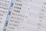 「ウォーキングより手軽にできる…医師･和田秀樹が｢幸せホルモンがわいてくる｣と勧める"室内5分の習慣"」の画像2