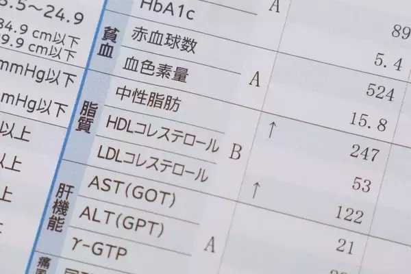 「ウォーキングより手軽にできる…医師･和田秀樹が｢幸せホルモンがわいてくる｣と勧める"室内5分の習慣"」の画像