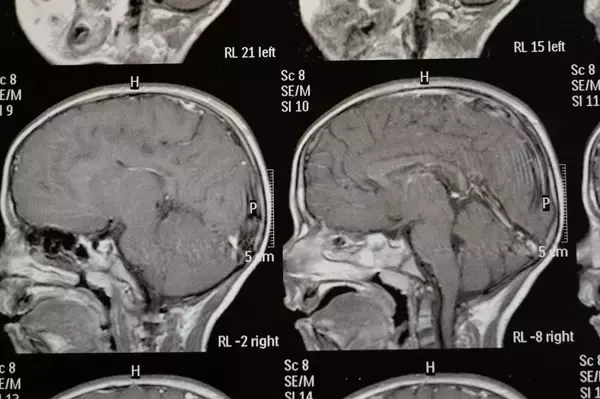 「｢手を繋いでくれんかね｣すがる認知症の老母に｢それだけはできない｣と答えた50代娘の幼い頃の悲しいトラウマ」の画像