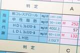 「｢悪玉コレステロールは悪者｣は大間違い…医師が｢低いとがん発症率が上がる｣という真の役割」の画像1