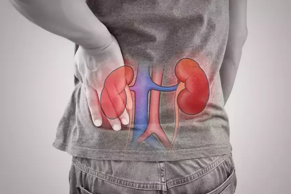 「｢健康にいい｣と思って毎日食べた→脂汗が止まらない激痛…15mm尿管結石を育てた60代男性の冷蔵庫の中身【2026年3月BEST】」の画像