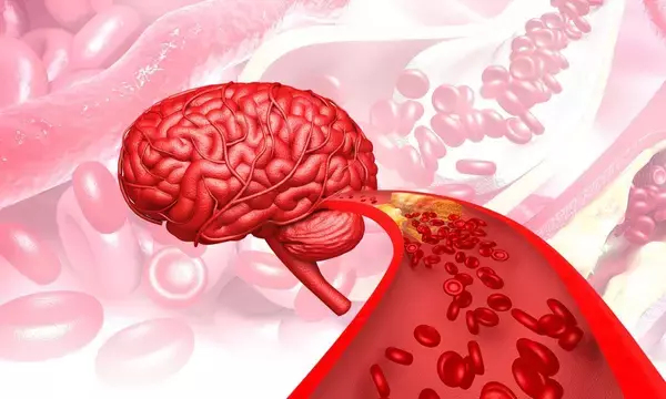 「｢ごちそうさまのタイミング｣を見ればヨボヨボ老人になるかわかる…医師｢認知症リスクを高める危険な食習慣｣」の画像