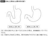 「｢胃がん予防に効果的｣のはずが…タバコを吸う人が飲むと発症率が2倍以上になる｢健康にいい飲み物｣の名前」の画像3