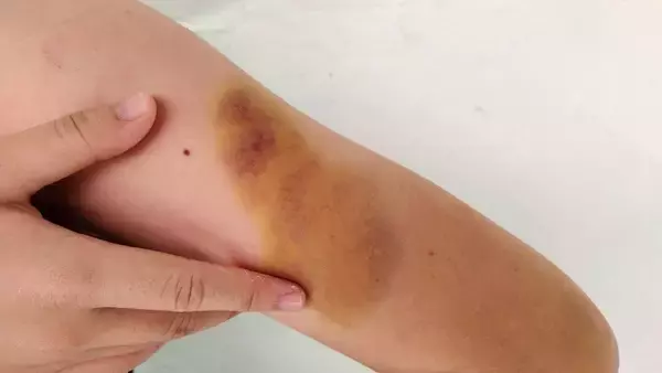 「日本の離婚訴訟は｢不倫したもん勝ち｣になっている…｢資産家の夫の不倫→離婚｣で妻が得る"まさかの慰謝料額"」の画像