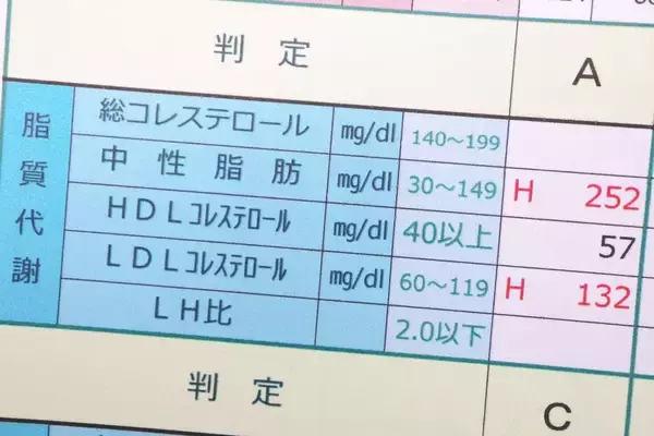 悪玉コレステロールが高いほうが｢がんやうつ病に強い｣…和田秀樹が｢健康診断を気にするな｣という理由