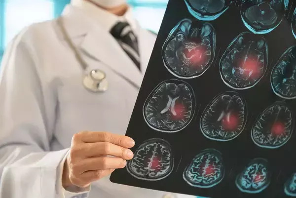 「最新研究でわかった｢長寿と短命｣をわける決定的違い…専門家が"デビル"と呼ぶ老化を起こす危険因子の正体」の画像