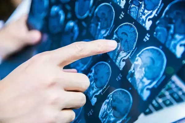 脳のピークは20代でも30代でもない…100歳のMRI画像を見た脳内科医｢80歳を超えて脳が成長する人の共通点｣