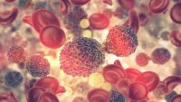 ｢がん｣と｢癌｣は同じ意味ではない…3カ月間｢原因不明の病｣に苦しんだ男性に医師が告げた｢珍しいがん｣の正体