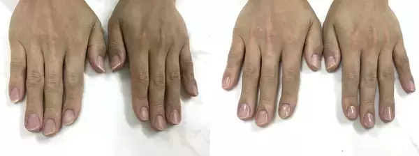 「元凶は服装でも髪型でもなかった…女性から｢清潔感がない｣と一瞬で嫌われる男性の"体の部位"」の画像