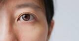「だから医師は必ず患者の下まぶたを下げて｢目｣を診る…白目やまぶたの裏に現れる｢重大な病気｣のサイン」の画像1