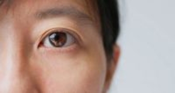 だから医師は必ず患者の下まぶたを下げて｢目｣を診る…白目やまぶたの裏に現れる｢重大な病気｣のサイン