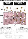 「腸の壁に穴が空き､全身がボロボロに…内科医が｢毎日食べてはダメ｣と警告する"みんな大好きな朝食の定番"【2026年4月BEST】」の画像2