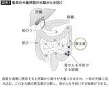 「酒･タバコと同じくらい危険…10年続けると｢大腸がん｣発症率が2倍に跳ね上がる､職場で毎日やっている習慣」の画像4