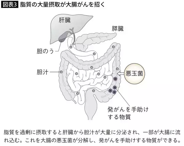 「酒･タバコと同じくらい危険…10年続けると｢大腸がん｣発症率が2倍に跳ね上がる､職場で毎日やっている習慣」の画像