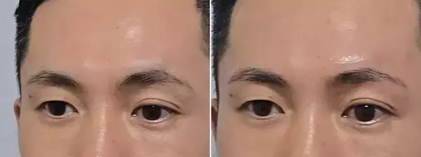 「仕事も結婚もできない男性は｢眉毛｣に問題がある…｢清潔感がない｣と一刀両断される"ダメ眉毛"7つの特徴」の画像