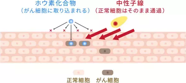 株式会社CICS（リゾートトラスト株式会社の連結子会社） BNCTの特定臨床研究に関する契約を江戸川病院と締結　～FDG-PET陽性の浅在性腫瘍に対する研究にBNCT用装置に関する技術を提供～