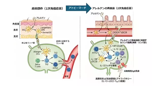 アトピー性皮膚炎を発端に症状が全身に拡大する「アトピーマーチ」のメカニズムを解明 ～IL-13と特定の樹状細胞の相互作用が高親和性IgE抗体産生を駆動する～