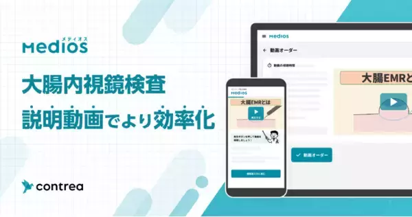 Contrea株式会社、大腸内視鏡検査の患者説明動画をリリース