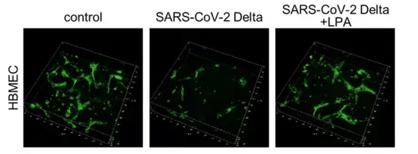 リゾホスファチジン酸がCOVID-19における血管損傷を防ぐことを世界で初めて実証