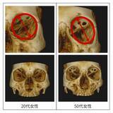 「顔のたるみは「肌」ではなく「骨」が原因！？」の画像1