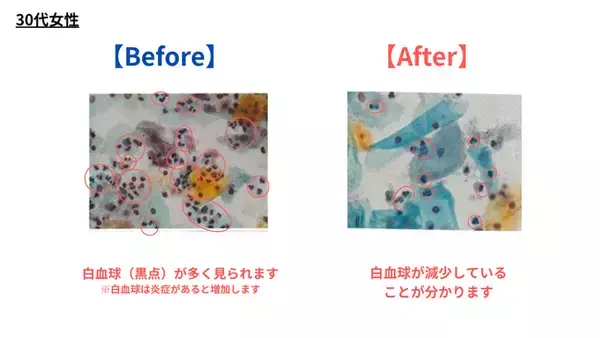 デリケートゾーンソープ、およびオイル使用による膣内フローラ調査結果